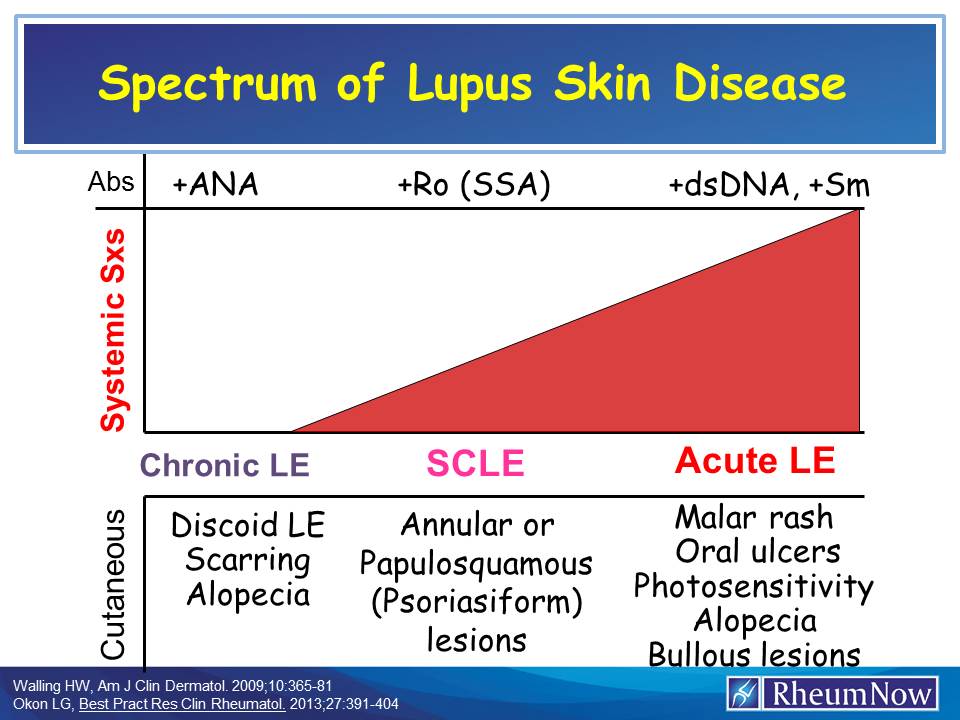 Spectrum of Lupus Skin Disease | RheumNow