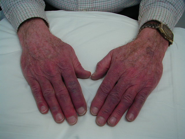 compounded tirzepatide fda Injectable Tirzepatide | Compounded GLP-1/GIP main image 0