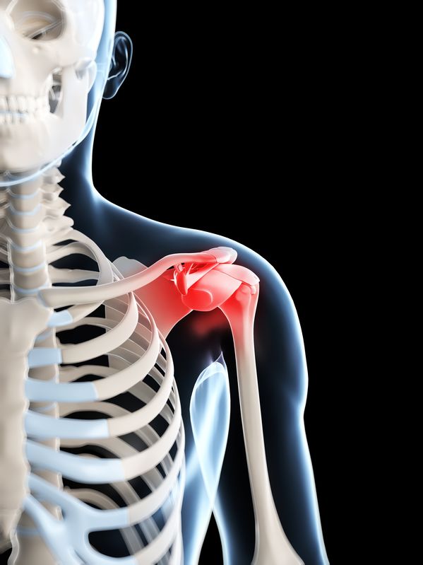 Timing of Shoulder Injections Impacts Surgical Infection Risk | RheumNow