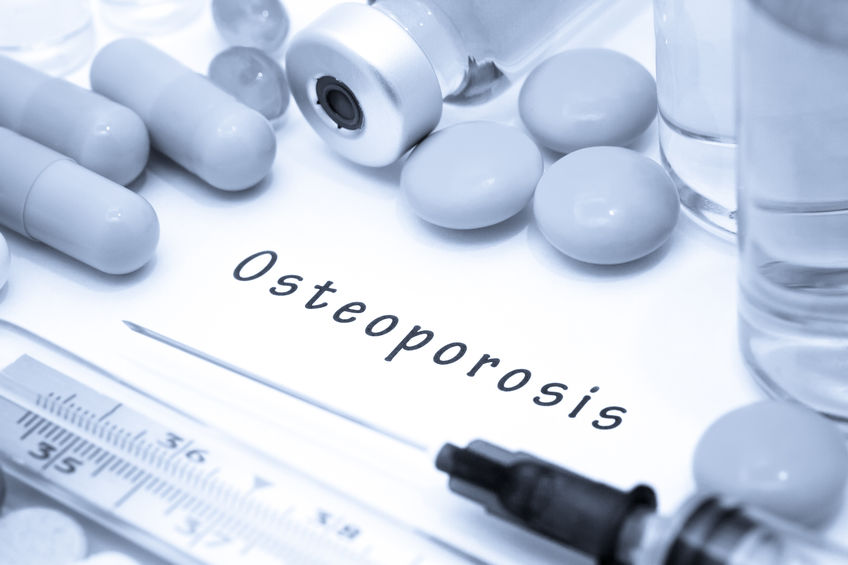 Guidelines For Osteoporosis Management In Postmenopausal Women RheumNow