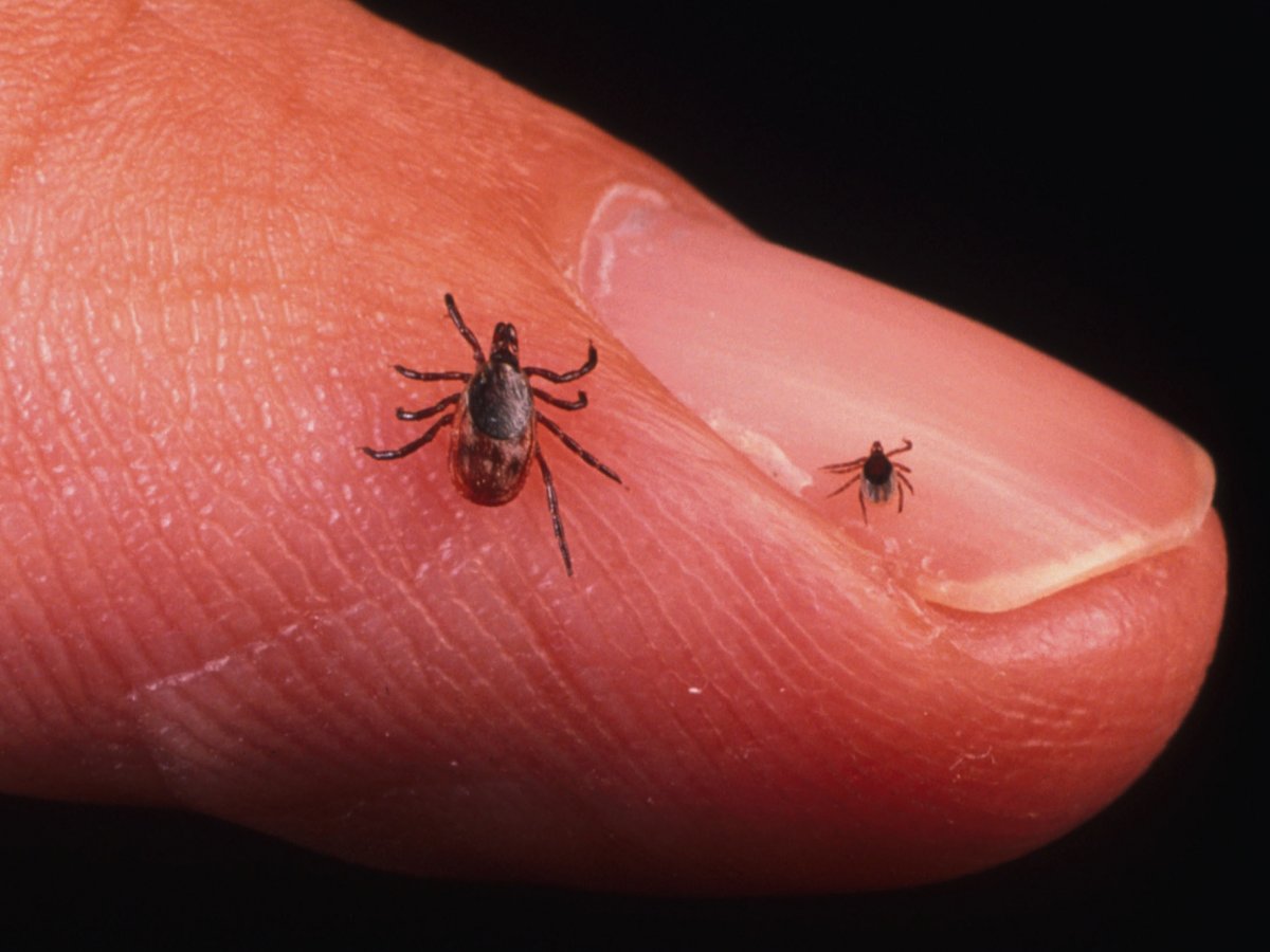 New Lyme Disease Guidelines RheumNow