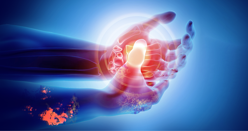 Geography of Arthritis-attributable Pain in the USA | RheumNow