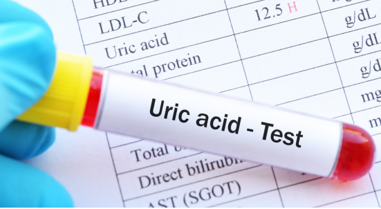 Saliva and Uric Acid Testing Save