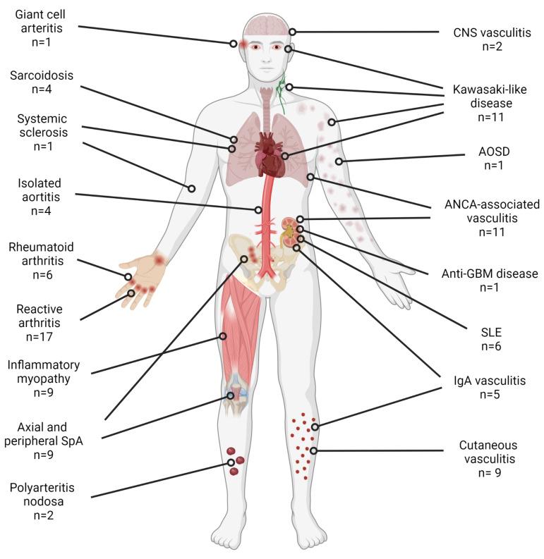 Covid,new,arthritis