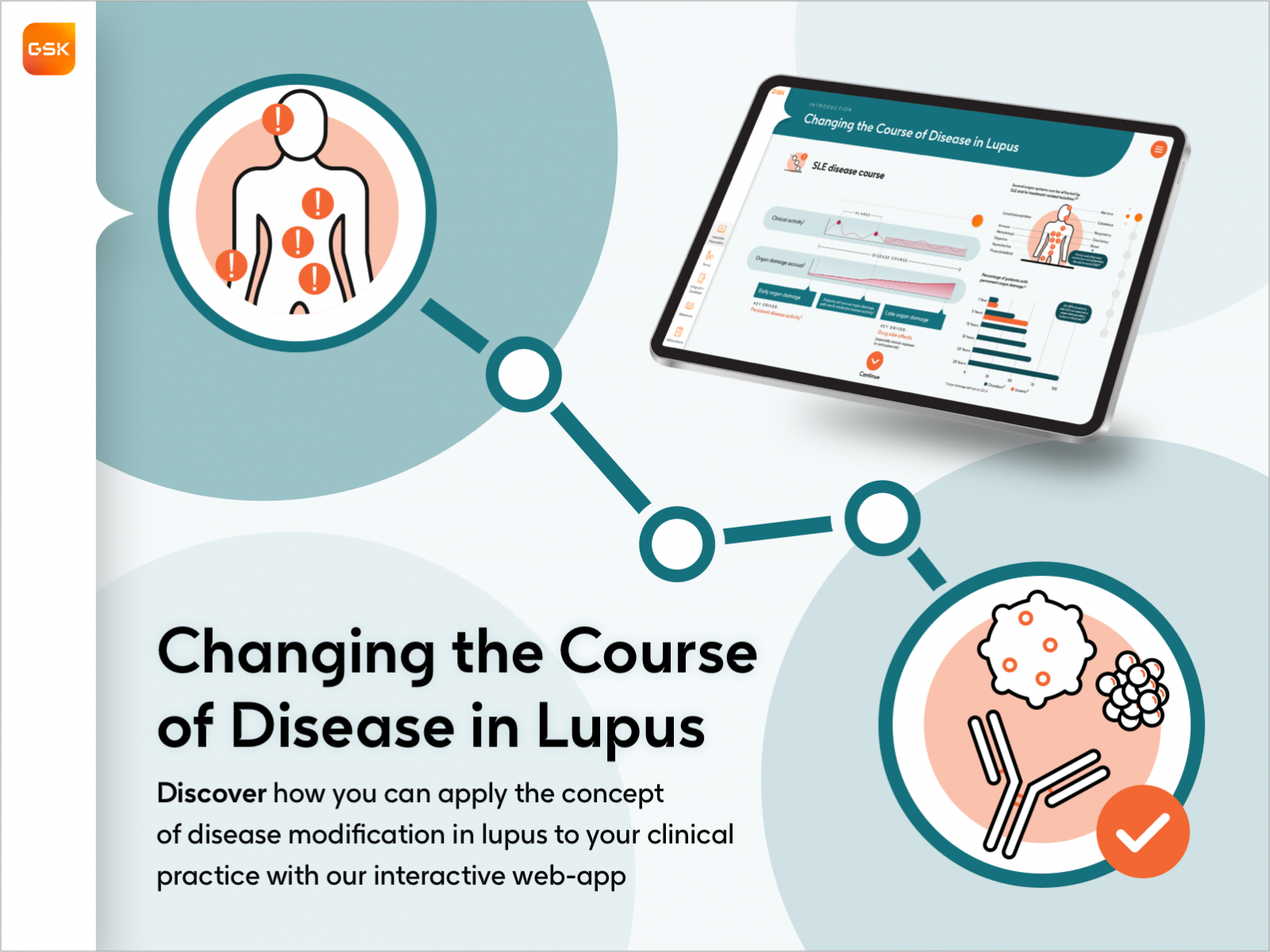 Changing the Course of the Disease in Lupus Case Study