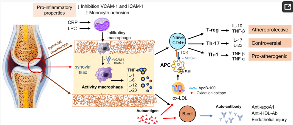 The influence of pro-inflammatory cytokines on lipid metabolism and the pro-atherogenic potential of immune cells in RA