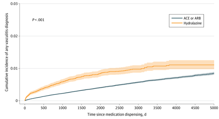 Hydralazine vasculitis