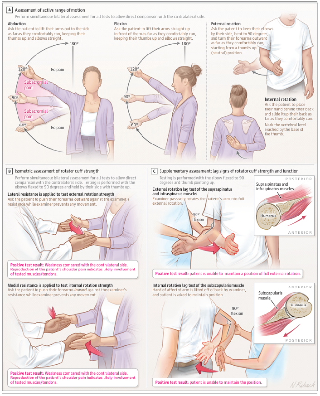 Shoulder exam