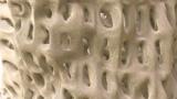 bone%20dense.jpg (keep)