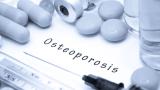 osteoporosis.OP_.Drugs_.jpg