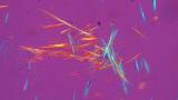 uric%20acid.crystals.gout_.JPG