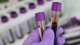 Blood labs 