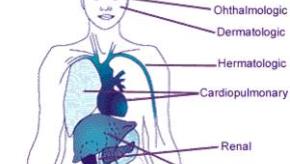 SLE.organ_.jpg