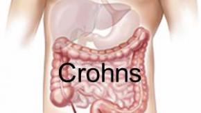 colon.Crohns.jpg