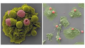 macrophages-engulf-dead-cells-617x416.jpg