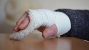 joint,fracture,hand,cast