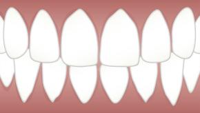 dental,periodontal