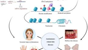 epigenetics,skin,autoimmune
