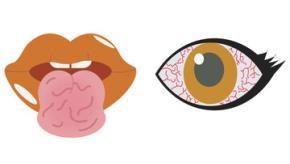 Sjogren.eye.mouth