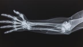 arm xray