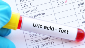 uric.acid.test