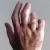 PsA Hand