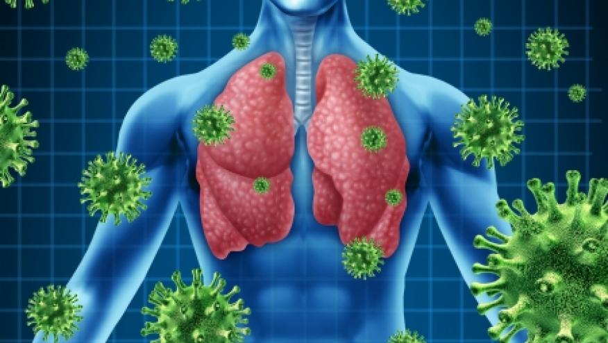 Lymphopenia and Steroids Increase the Risk of Pneumocystis Jiroveci in ...