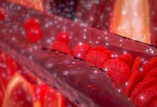 RA.vascular.cholesterol.plaque.jpg
