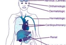SLE.organ_.jpg