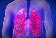 lung%2Cbright.jpg