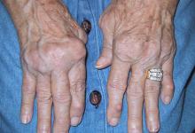 ra.hands2_.JPG