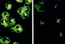 ANCA, vasculitis, test
