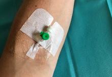 IV,arm,intravenous,infusion