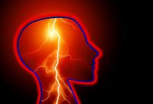 epilepsy,brain,seizure,CVA