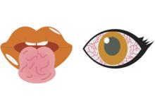 Sjogren.eye.mouth