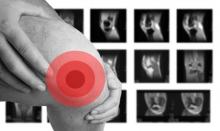 MRI.kneepain.jpg