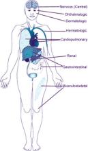 SLE.organ_.jpg