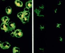 ANCA, vasculitis, test