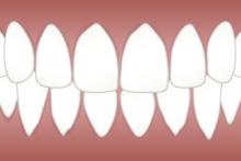 dental,periodontal