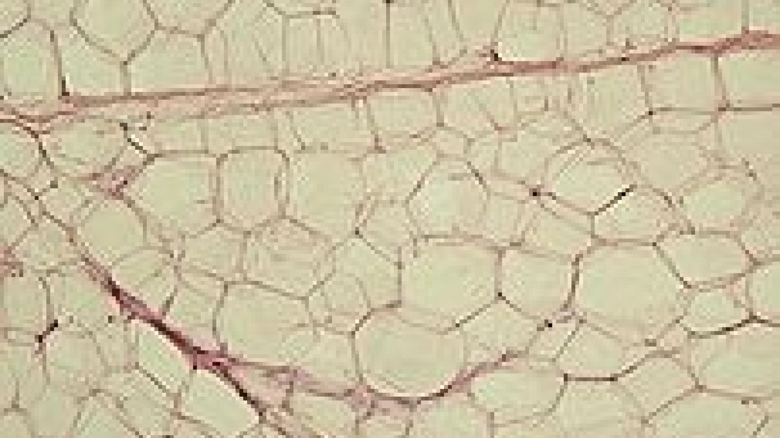 202px-Yellow_adipose_tissue_in_paraffin_section_-_lipids_washed_out.jpg