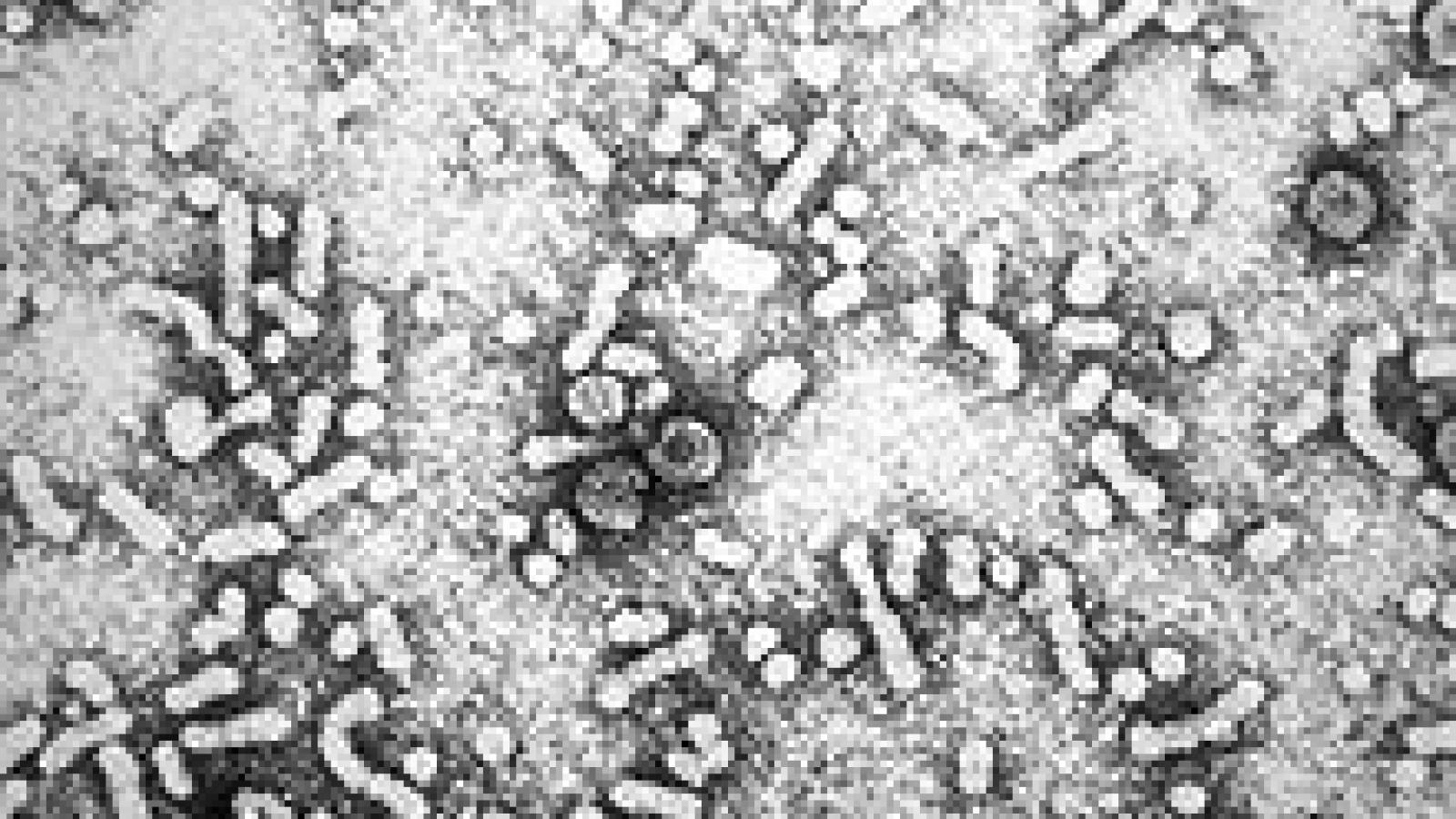 Hepatitis B (Keep)