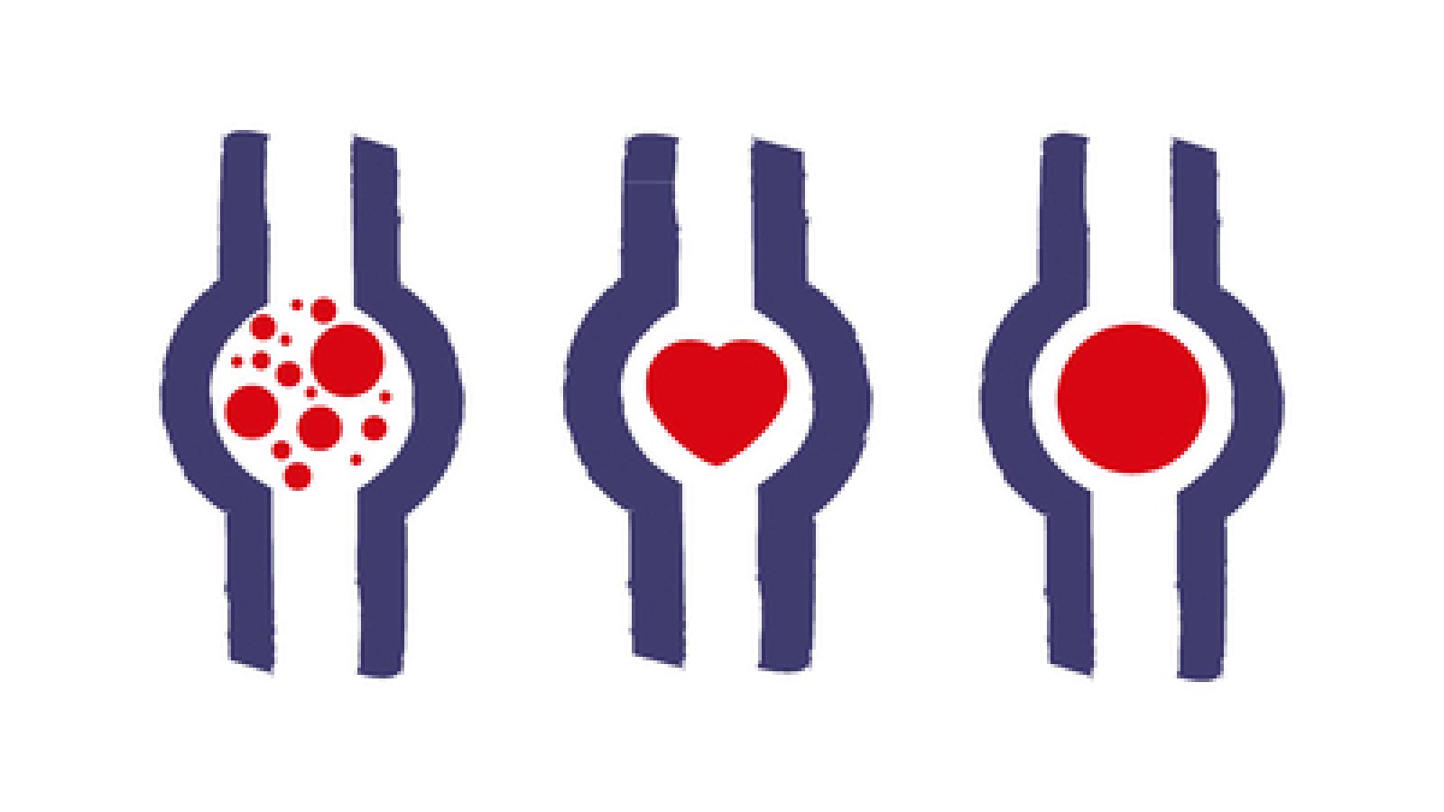 DVT.PE_.Blood_.jpg