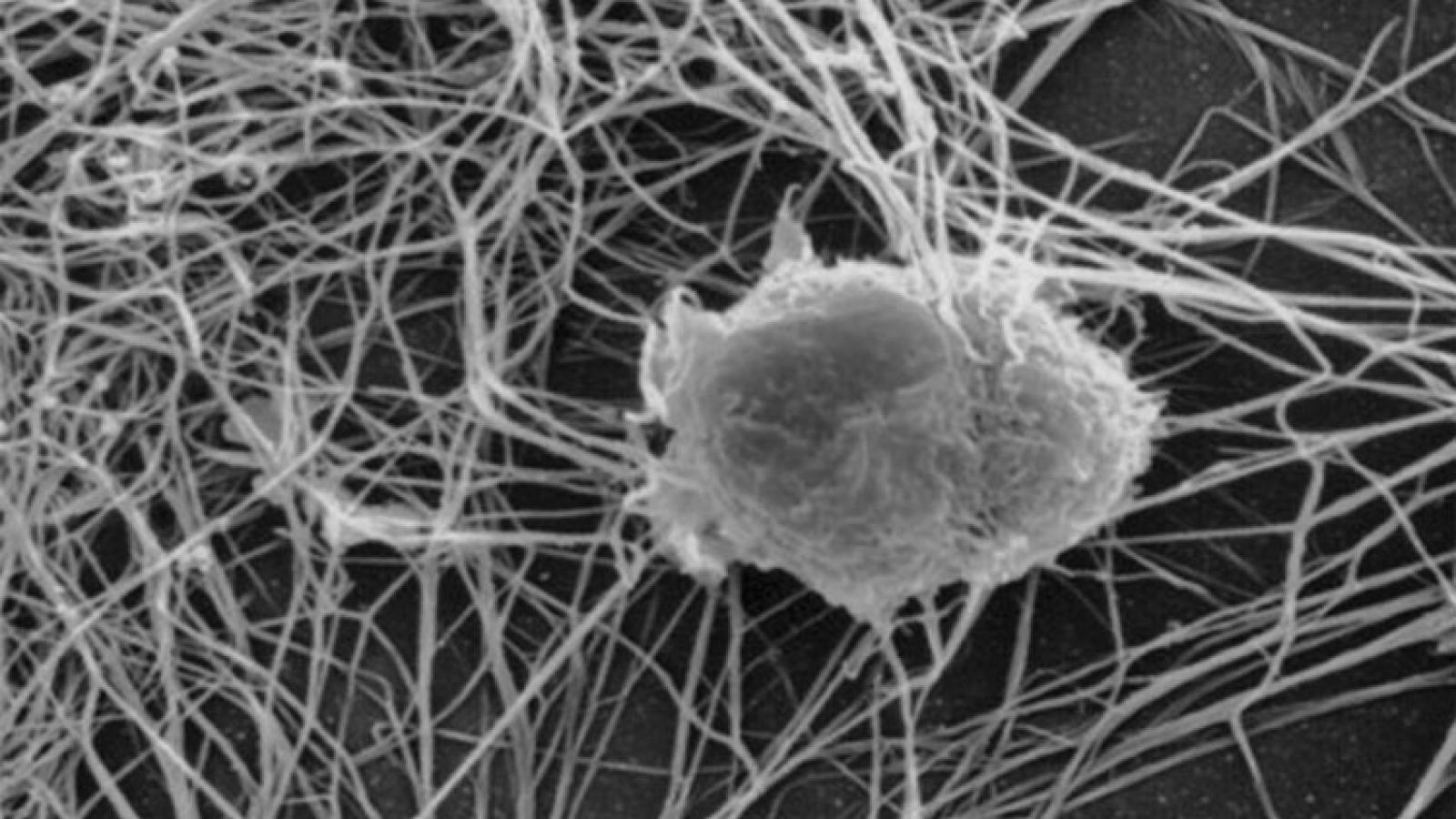 Dendritic_Cell.jpg