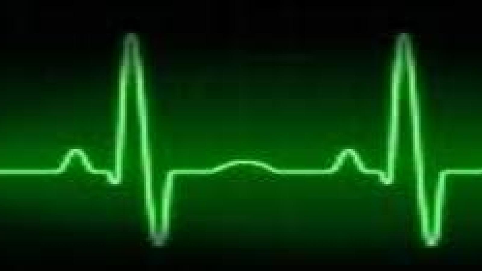 ECG2.jpg