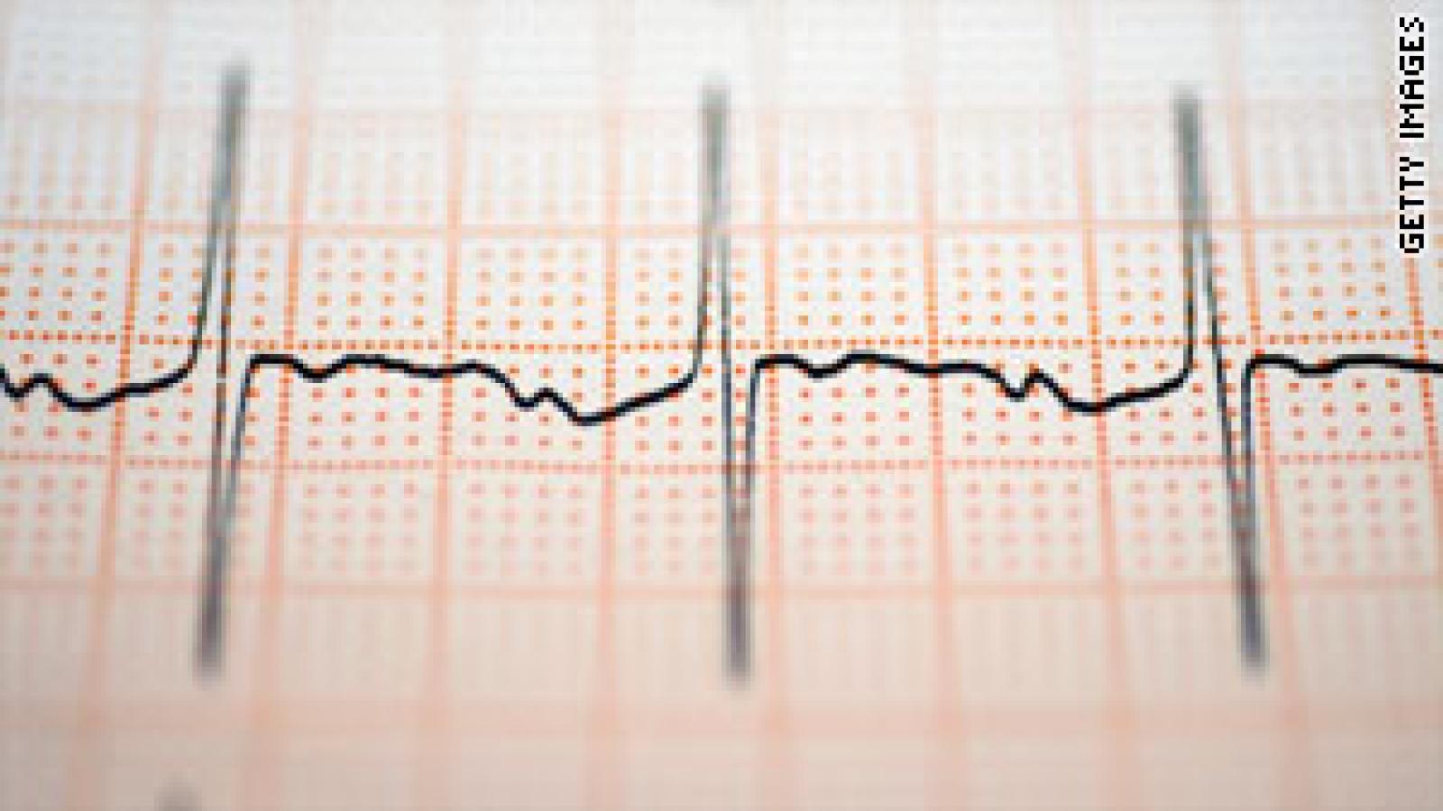 EKG.getty_.jpg (keep)