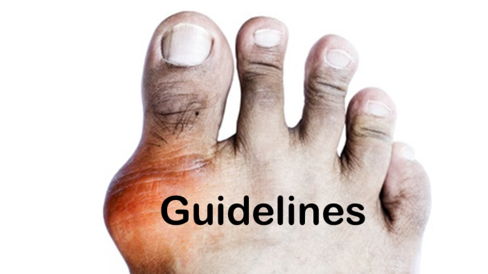Gout.Guidelines.png