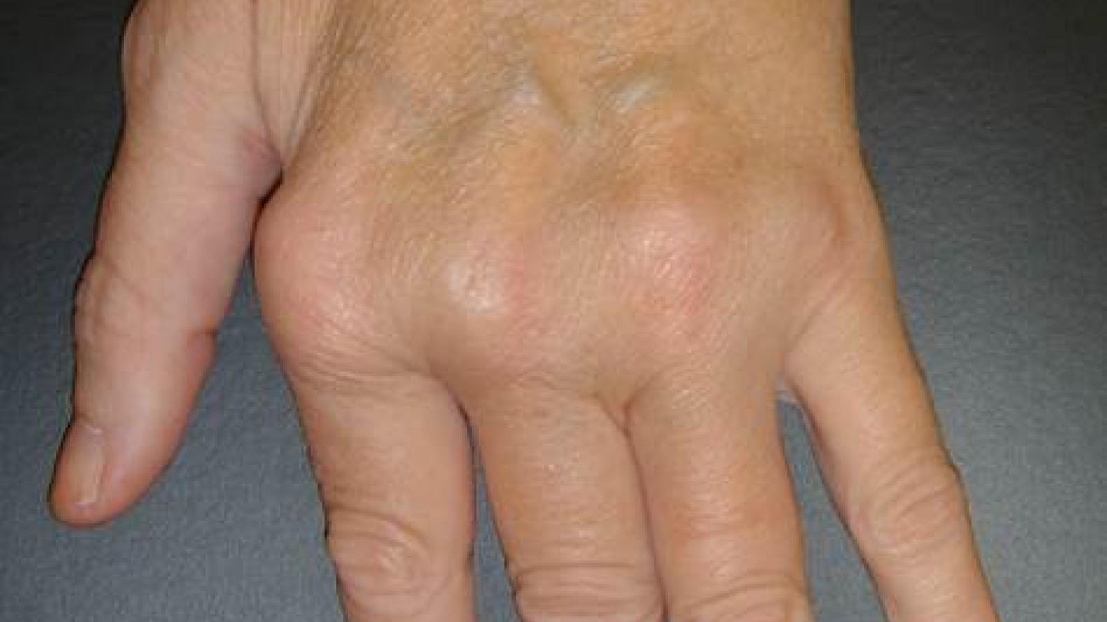 Hand.LC_.jpg