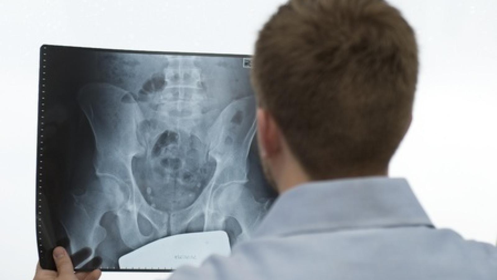 Hip%20Xray.jpg