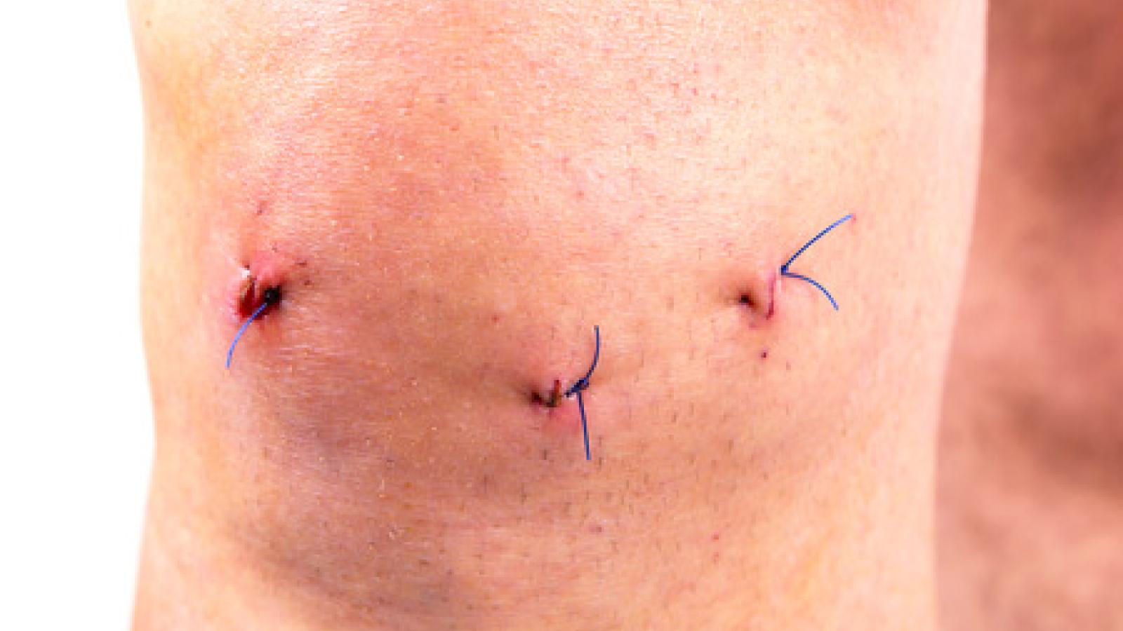 Knee.arthroscopic.jpg