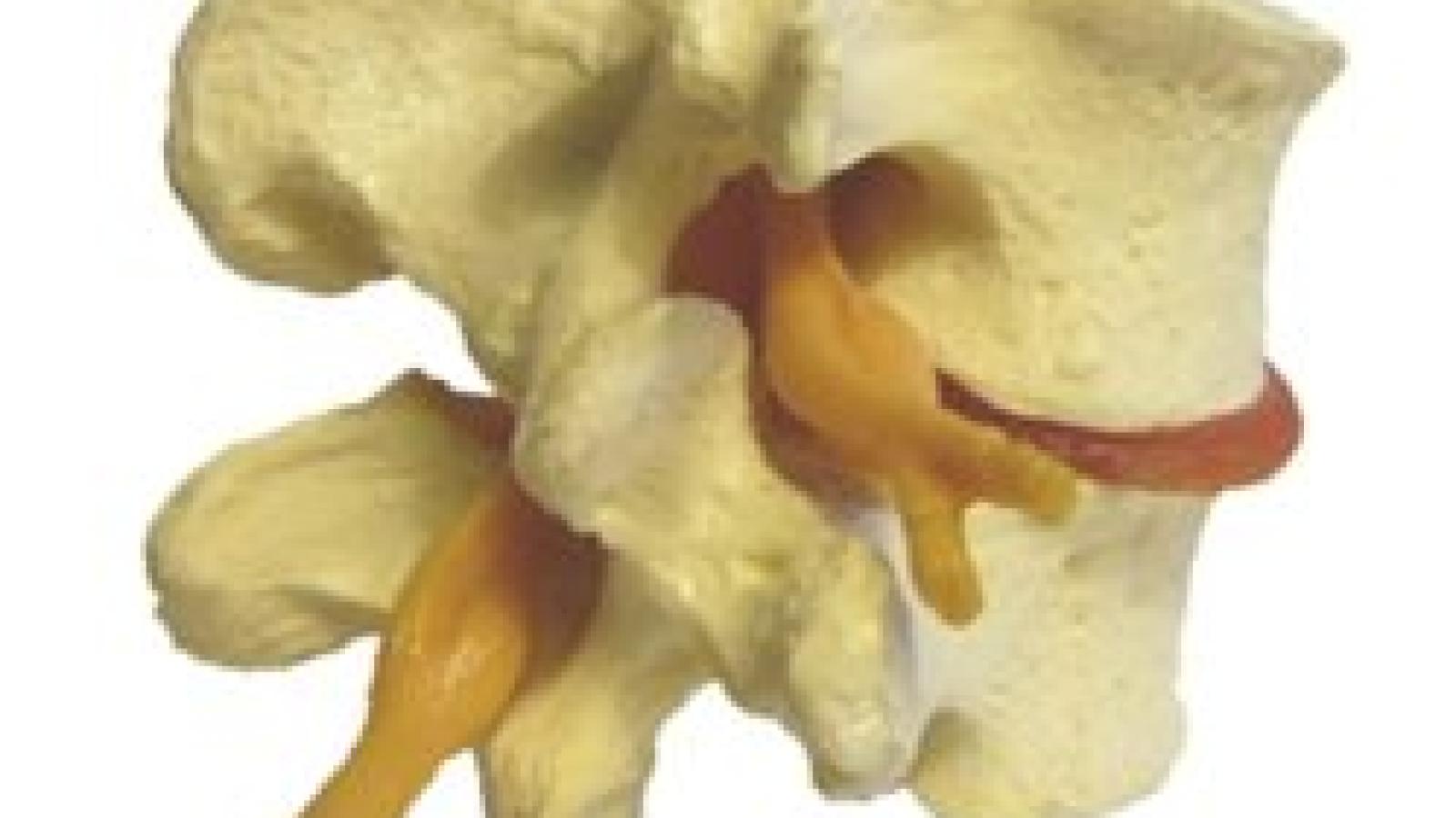Lumbar.jpg